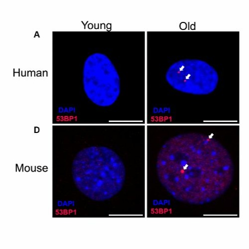 Reducing Double-strand DNA Break Repair Exacerbates Vascular Aging