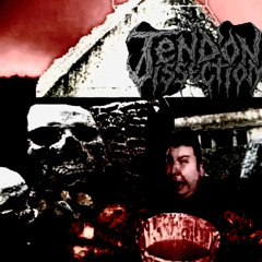 Pulling Out The Bones