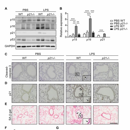 p21 Facilitates Chronic Lung Inflammation via Epithelial and Endothelial Cells