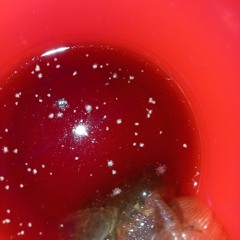 vulvectomy🩸🦴🫀