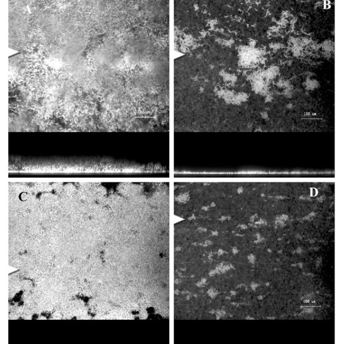 SEIZURES - Quorum Sensing
