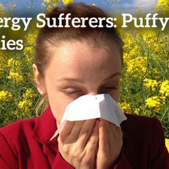 Best Allergy Puffy Eyes Treatment Reviews