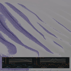 Beat your competition (BRGR remix)