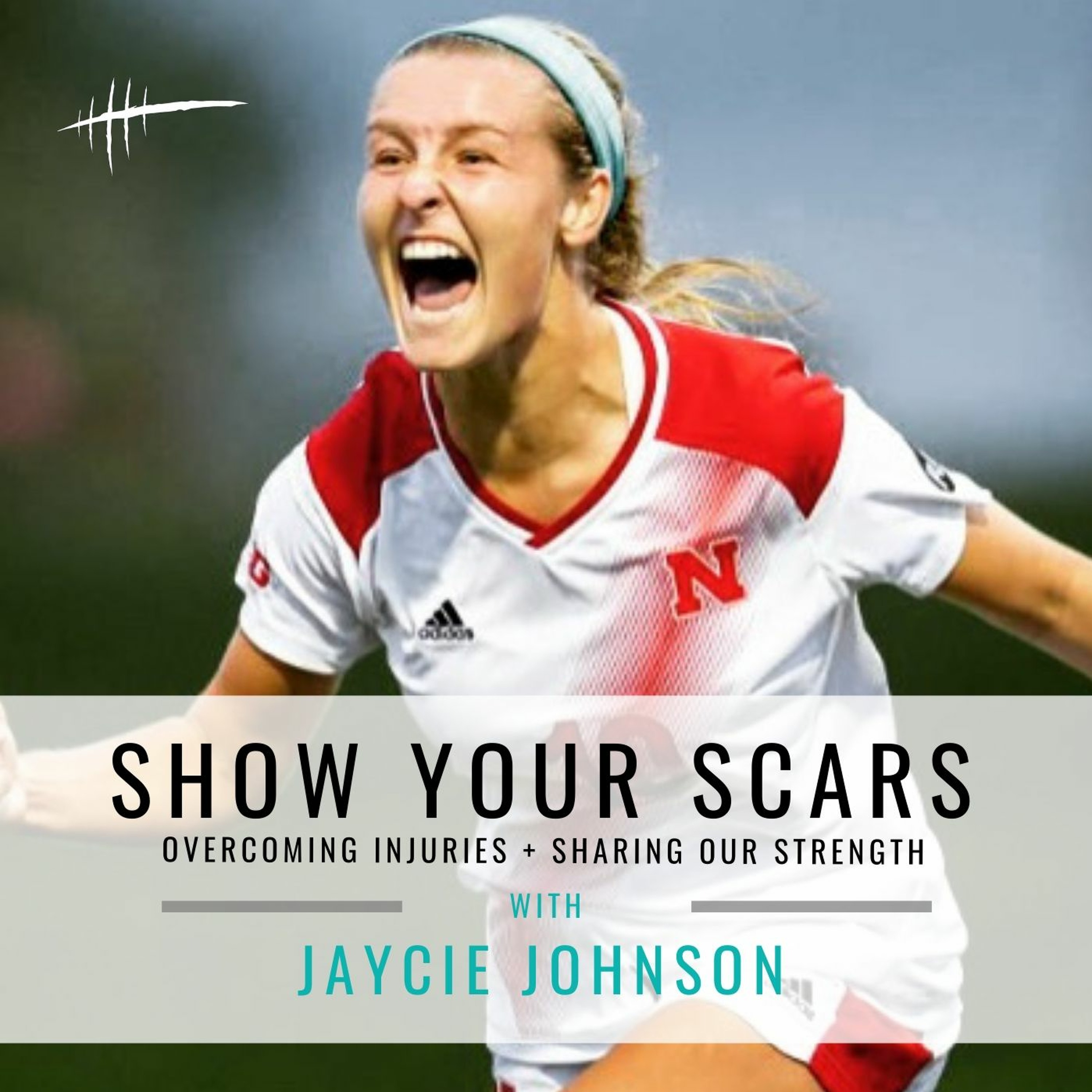 Show Your Scars