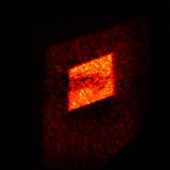 Anomaly