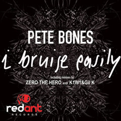 I Bruise Easily (Zero the Hero Remix)