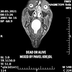 Pavel Krejdl - Dead Or Alive