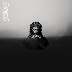 Scars
