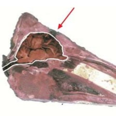 detoxification mudra