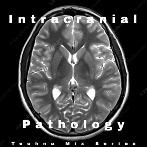 Intracranial Pathology Mix Series - Episode 1 (CRAØD)