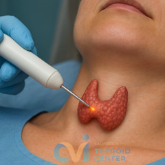 Thyroid Goiter Symptoms You Need to Watch Out For