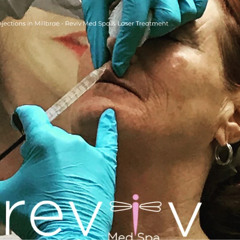 Lip injections in Millbrae - Reviv Med Spa & Laser Treatment