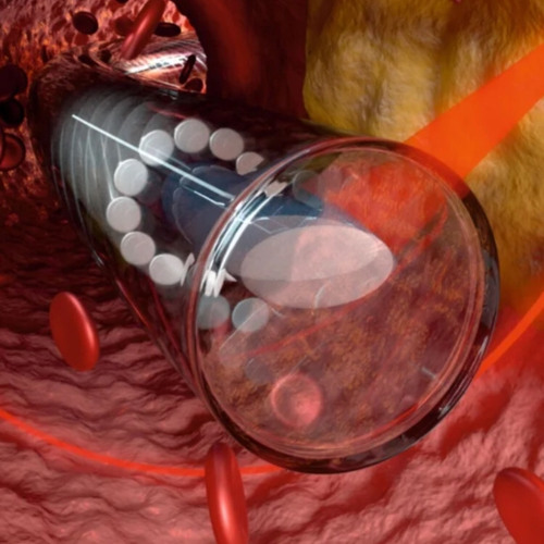 F1B3R-ØP71C-B1Ø73CH