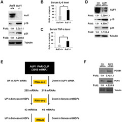 AUF1 Protein Plays Anti-Aging Role by Regulating Cellular Metabolism
