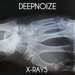 X - Rays