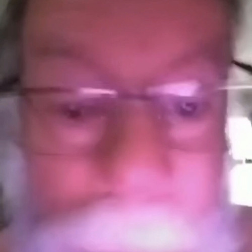 Asshole Close Up Pictures