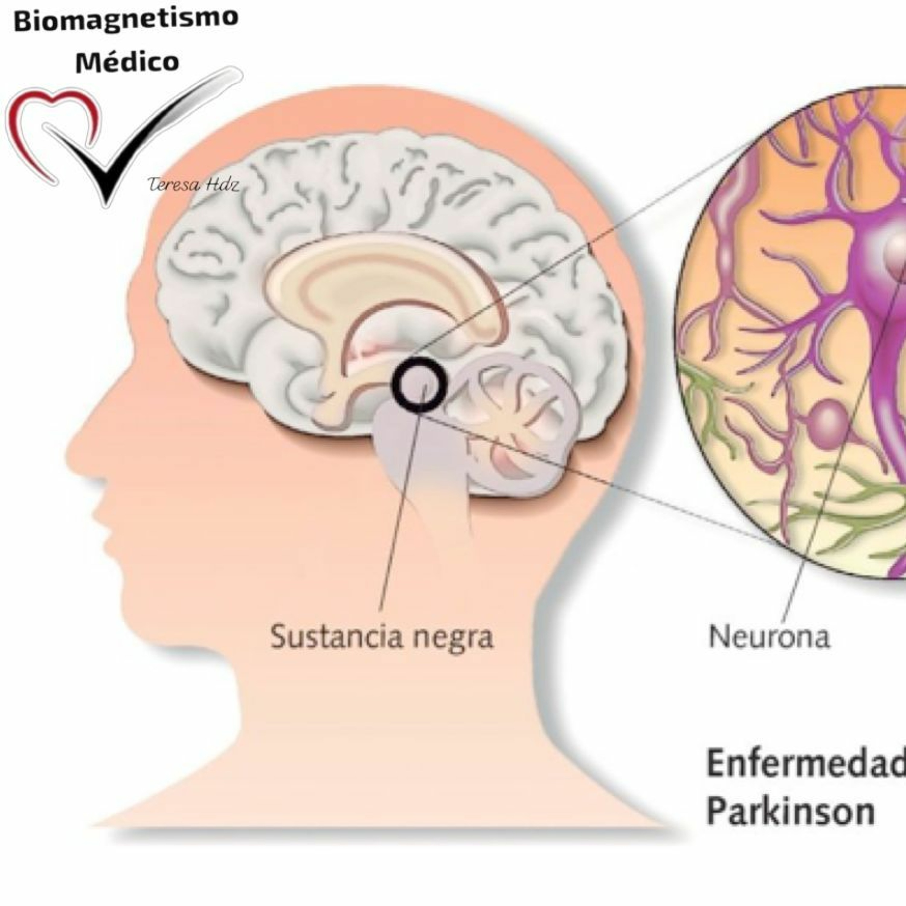 Protocolo Para Parkinson Con Biomagnetismo episode artwork