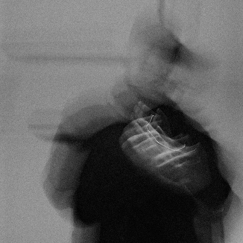 NIUB - Discover v1 (preview)