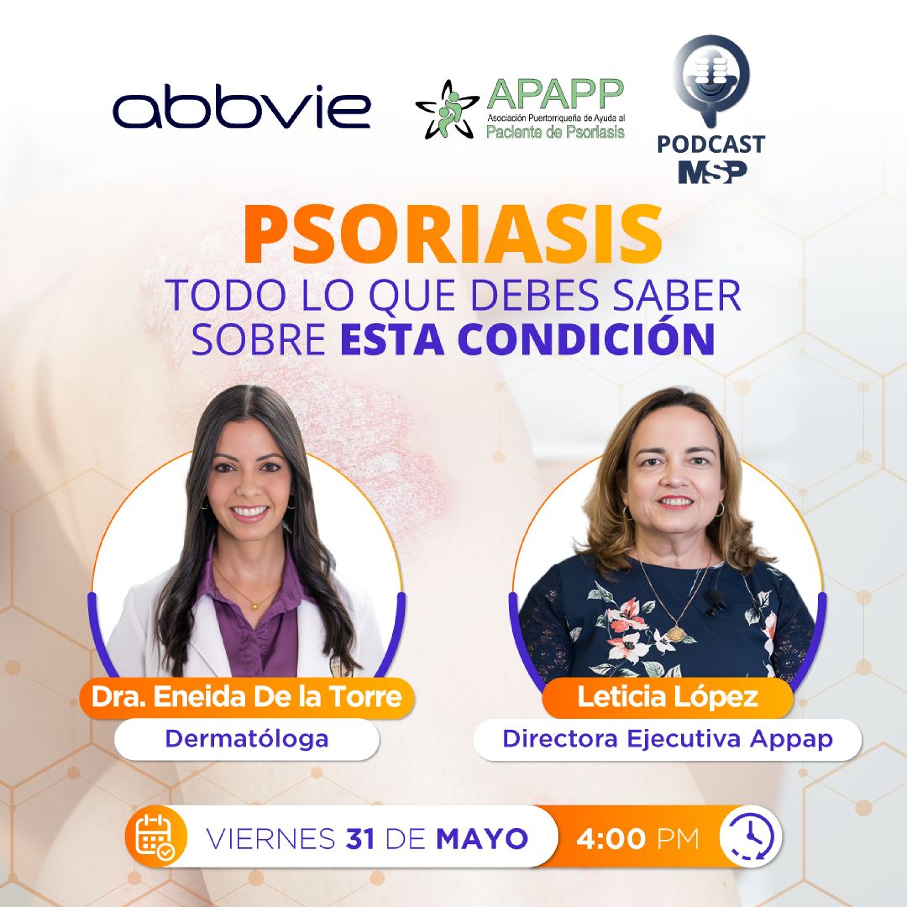 Psoriasis: Todo lo que debes saber de esta condición episode artwork