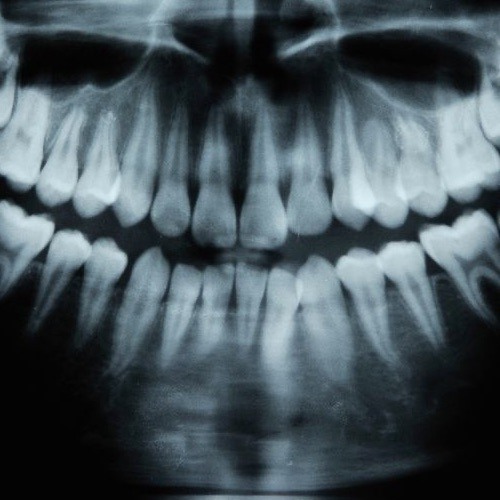 Teeth (Instrumental)