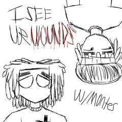 iseeurwounds (prod. sickboi)