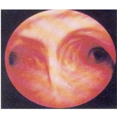 rabia - loca (prod. fiftyzeros)