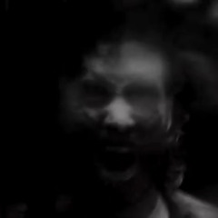 necrosis prod. by nxm1nal