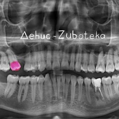 deHuc - Zuboteka