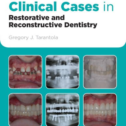 [VIEW] PDF 📥 Clinical Cases in Restorative and Reconstructive Dentistry by  Gregory