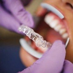 Invisalign Şeffaf Plak - İstanbul & Fiyatları | dentofficial.com
