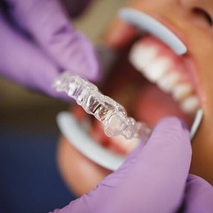 Invisalign Transparent Aligners - Istanbul & Prices | dentofficial.com