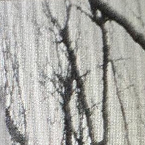 HATE OR HATE // ART.14