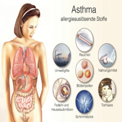 allergisches asthma (prod. SBM)