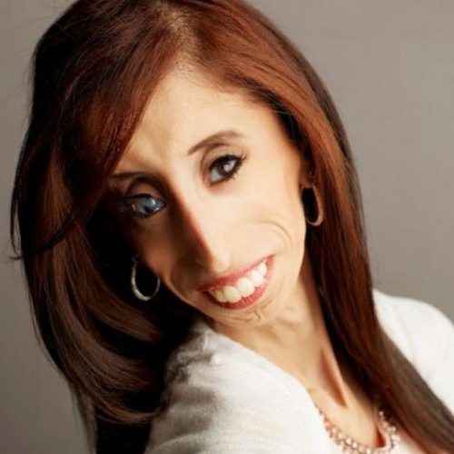 Lizzie Velasquez Pics