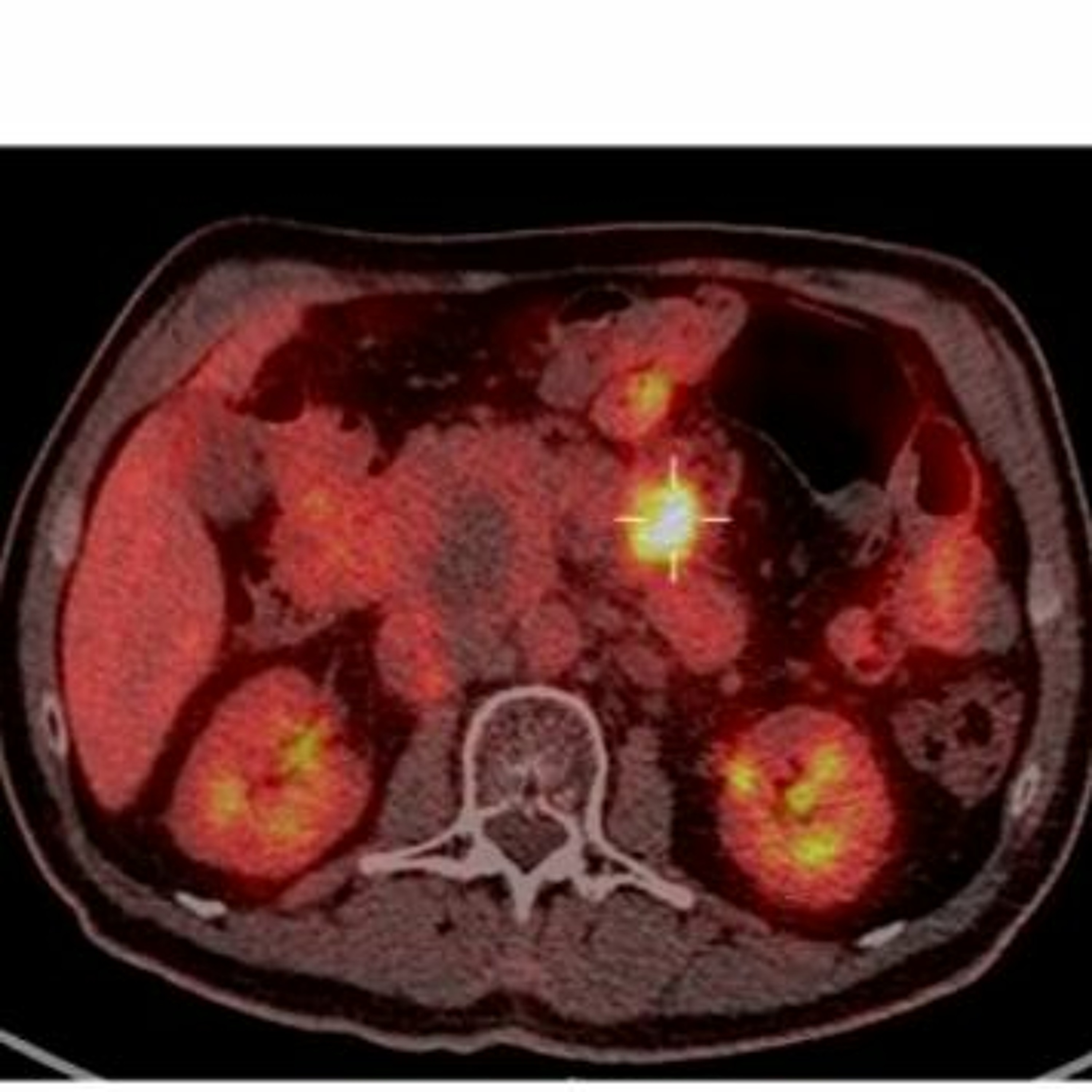Oncotarget