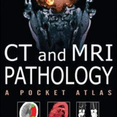 [Free] EBOOK 💝 CT & MRI Pathology: A Pocket Atlas, Second Edition by  Michael Grey &