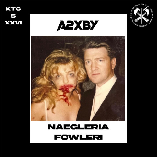A2XBY - NAEGLERIA FOWLERI [KTCS026]