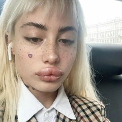 X3(парт Хофманниты)