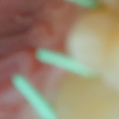 Broken Tooth