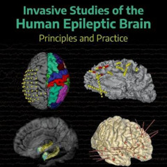 [GET] EBOOK 📪 Invasive Studies of the Human Epileptic Brain: Principles and Practice