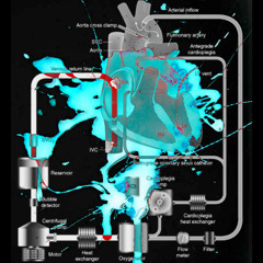 Rapid Transfusion
