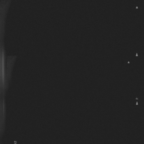 Antipute 2 (Ft. Karlo & Amk + Lynx)