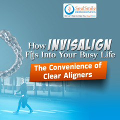 How Invisalign Fits Into Your Busy Life: The Convenience of Clear Aligners