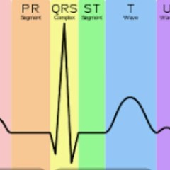Electrolyte Effect On The ECG