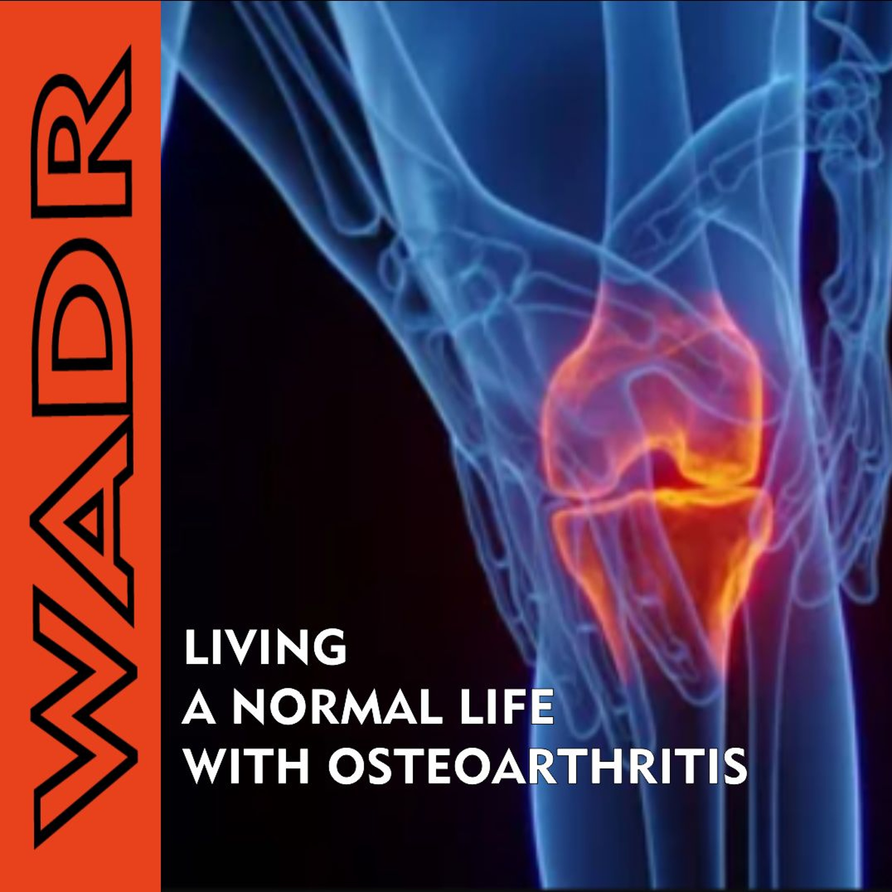 Living well with osteoarthritis: Tips for managing joint pain - Welbodi episode artwork