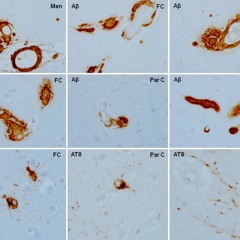 Brain Aging and Alzheimer’s: Insights from Non-Human Primates