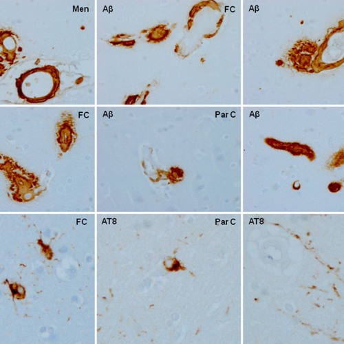 Brain Aging and Alzheimer’s: Insights from Non-Human Primates
