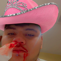 FrescoK (Dougie got hit)(DougieK pt 2)