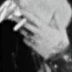 eyeofnervosa (demo)