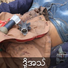Episode 336:၁၀၂၇ စစ်ဆင်ရေးနောက်ပိုင်းမြေမြှပ်မိုင်းကြောင့်ထိခိုက်သေဆုံးမှုတွေများလာတဲ့ရှမ်းမြောက်